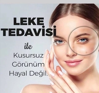 hizmet LEKE TEDAVİSİ